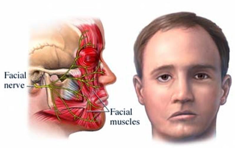 O que é o nervo facial